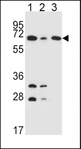 DLAT / PDC-E2 Antibody - DLAT Antibody western blot of K562(lane 1),HepG2(lane 2),Jurkat(lane 3) cell line lysates (35 ug/lane). The DLAT antibody detected the DLAT protein (arrow).