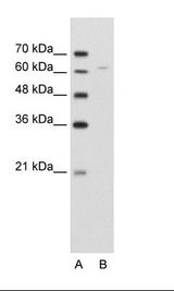 DLAT / PDC-E2 Antibody - A: Marker, B: Jurkat Cell Lysate.  This image was taken for the unconjugated form of this product. Other forms have not been tested.