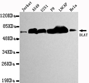DLAT / PDC-E2 Antibody - Western blot detection of DLAT in Jurkat,A549,U251,F9,LNCAP&Hela cell lysates using DLAT antibody (1:1000 diluted).