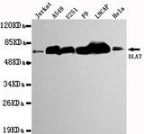 DLAT / PDC-E2 Antibody - Western blot detection of DLAT in Jurkat,A549,U251,F9,LNCAP&Hela cell lysates using DLAT antibody (1:1000 diluted).