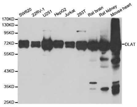 DLAT / PDC-E2 Antibody - Western blot analysis of extracts of various cell lines.