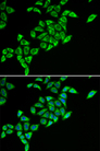 DLAT / PDC-E2 Antibody - Immunofluorescence analysis of HeLa cells.