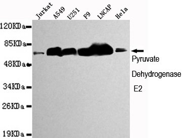 DLAT / PDC-E2 Antibody - Western blot detection of Pyruvate Dehydrogenase E2 in Jurkat, A549, U251, F9, Lncap and HeLa cell lysates using Pyruvate Dehydrogenase E2 mouse monoclonal antibody (1:1000 dilution). Predicted band size: 69KDa. Observed band size:69KDa.