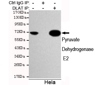 DLAT / PDC-E2 Antibody - Immunoprecipitation analysis of HeLa cell lysates using Pyruvate Dehydrogenase E2 mouse monoclonal antibody.