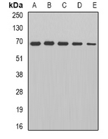 DLAT / PDC-E2 Antibody - Western blot analysis of PDC-E2 expression in HepG2 (A); Jurkat (B); mouse heart (C); rat brain (D); rat kidney (E) whole cell lysates.