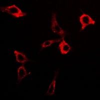 DLAT / PDC-E2 Antibody - Immunofluorescent analysis of PDC-E2 staining in HeLa cells. Formalin-fixed cells were permeabilized with 0.1% Triton X-100 in TBS for 5-10 minutes and blocked with 3% BSA-PBS for 30 minutes at room temperature. Cells were probed with the primary antibody in 3% BSA-PBS and incubated overnight at 4 deg C in a humidified chamber. Cells were washed with PBST and incubated with a DyLight 594-conjugated secondary antibody (red) in PBS at room temperature in the dark.