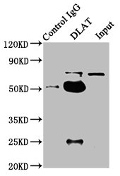 DLAT / PDC-E2 Antibody - Immunoprecipitating DLAT in HepG2 whole cell lysate Lane 1: Rabbit control IgG instead of DLAT Antibody in HepG2 whole cell lysate.For western blotting, a HRP-conjugated Protein G antibody was used as the secondary antibody (1/2000) Lane 2: DLAT Antibody (6µg) + HepG2 whole cell lysate (1mg) Lane 3: HepG2 whole cell lysate (20µg)