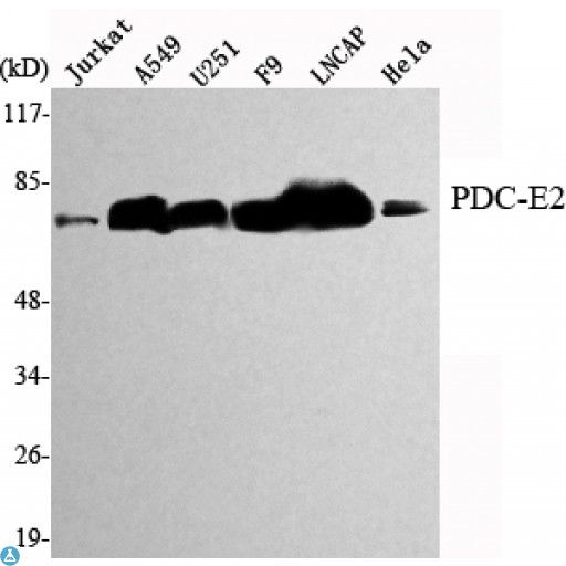 DLAT / PDC-E2 Antibody - Western Blot (WB) analysis using PDC-E2 Monoclonal Antibody against Jurkat, A549, U251, F9, LNCAP, HeLa cell lysate.