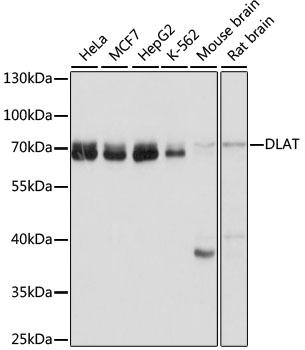 DLAT / PDC-E2 Antibody - Western blot analysis of extracts of various cell lines using DLAT Polyclonal Antibody at dilution of 1:1000.