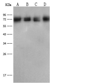 DLAT / PDC-E2 Antibody - Anti-DLAT rabbit polyclonal antibody at 1:500 dilution. Lane A: HepG2 Whole Cell Lysate. Lane B: A431 Whole Cell Lysate. Lane C: Jurkat Whole Cell Lysate. Lane D: A549 Whole Cell Lysate. Lysates/proteins at 30 ug per lane. Secondary: Goat Anti-Rabbit IgG (H+L)/HRP at 1/10000 dilution. Developed using the ECL technique. Performed under reducing conditions. Predicted band size: 69 kDa. Observed band size: 72 kDa.