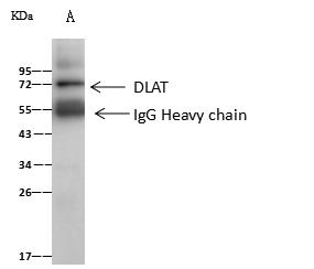 DLAT / PDC-E2 Antibody - DLAT was immunoprecipitated using: Lane A: 0.5 mg Jurkat Whole Cell Lysate. 2 uL anti-DLAT rabbit polyclonal antibody and 60 ug of Immunomagnetic beads Protein A/G. Primary antibody: Anti-DLAT rabbit polyclonal antibody, at 1:100 dilution. Secondary antibody: Goat Anti-Rabbit IgG (H+L)/HRP at 1/10000 dilution. Developed using the ECL technique. Performed under reducing conditions. Predicted band size: 69 kDa. Observed band size: 72 kDa.