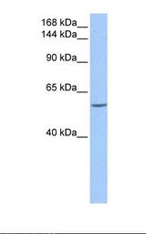 DLC1 Antibody - 721_B cell lysate. Antibody concentration: 0.5 ug/ml. Gel concentration: 6%-18%.  This image was taken for the unconjugated form of this product. Other forms have not been tested.