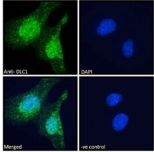 DLC1 Antibody - Goat Anti-DLC1 (Isoforms 1 and 3) Antibody Immunofluorescence analysis of paraformaldehyde fixed U251 cells, permeabilized with 0.15% Triton. Primary incubation 1hr (10ug/ml) followed by Alexa Fluor 488 secondary antibody (2ug/ml), showing nuclear and vesicle staining. The nuclear stain is DAPI (blue). Negative control: Unimmunized goat IgG (10ug/ml) followed by Alexa Fluor 488 secondary antibody (2ug/ml).