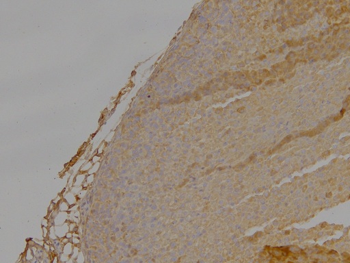 DLC1 Antibody - Goat Anti-DLC1 (Isoforms 1 and 3) Antibody Negative Control showing staining of paraffin embedded Mouse Adrenal Gland, with no primary antibody.