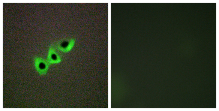 DLC1 Antibody - Immunofluorescence analysis of A549 cells, using RHG07 Antibody. The picture on the right is blocked with the synthesized peptide.