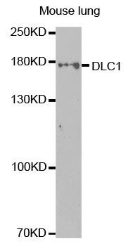 DLC1 Antibody - Western blot analysis of extracts of mouse lung cell lines.