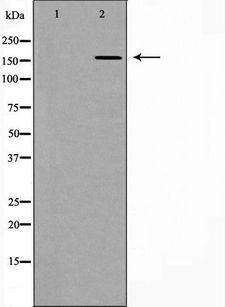 DLC1 Antibody - Western blot analysis of extracts of mouse lung using DLC1 antibody. The lane on the left is treated with the antigen-specific peptide.