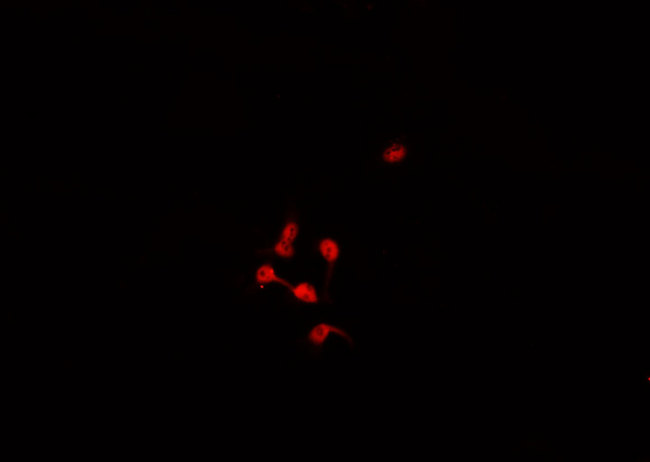 DLC1 Antibody - Staining HepG2 cells by IF/ICC. The samples were fixed with PFA and permeabilized in 0.1% Triton X-100, then blocked in 10% serum for 45 min at 25°C. The primary antibody was diluted at 1:200 and incubated with the sample for 1 hour at 37°C. An Alexa Fluor 594 conjugated goat anti-rabbit IgG (H+L) antibody, diluted at 1/600, was used as secondary antibody.