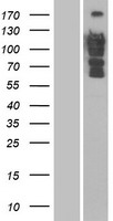 DLC1 Protein - Western validation with an anti-DDK antibody * L: Control HEK293 lysate R: Over-expression lysate