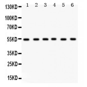 DLD / Diaphorase / E3 Antibody - DLD antibody Western blot. All lanes: Anti DLD at 0.5 ug/ml. Lane 1: Rat Brain Tissue Lysate at 50 ug. Lane 2: Rat Liver Tissue Lysate at 50 ug. Lane 3: Rat Testis Tissue Lysate at 50 ug. Lane 4: Mouse Ovary Tissue Lysate at 50 ug. Lane 5: HELA Whole Cell Lysate at 40 ug. Lane 6: SMMC Whole Cell Lysate at 40 ug. Predicted band size: 54 kD. Observed band size: 54 kD.