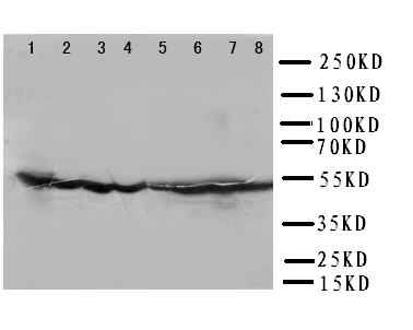 DLD / Diaphorase / E3 Antibody - WB of DLD / Diaphorase / E3 antibody. Lane 1: Rat Liver Tissue Lysate. Lane 2: Rat Brain Tissue Lysate. Lane 3: Rat Ovary Tissue Lysate. Lane 4: Rat Testis Tissue Lysate. Lane 5: SMMC Cell Lysate. Lane 6: HELA Cell Lysate. Lane 7: SMMC Cell Lysate. Lane 8: JURKAT Cell Lysate.