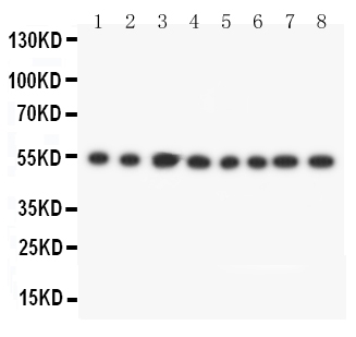 DLD / Diaphorase / E3 Antibody - Anti-DLD antibody, Western blotting Lane 1: Rat Liver Tissue LysateLane 2: Rat Brain Tissue LysateLane 3: Rat Ovary Tissue LysateLane 4: Rat Testis Tissue LysateLane 5: SMMC Cell LysateLane 6: HELA Cell LysateLane 7: SMMC Cell LysateLane 8: JURKAT Cell Lysate