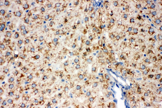 DLD / Diaphorase / E3 Antibody - IF analysis of DLD using anti-DLD antibody DLD was detected in paraffin-embedded section of rat liver tissues. Heat mediated antigen retrieval was performed in citrate buffer (pH6, epitope retrieval solution ) for 20 mins. The tissue section was blocked with 10% goat serum. The tissue section was then incubated with 1µg/mL rabbit anti-DLD antibody overnight at 4°C. DyLight®488 Conjugated Goat Anti-Rabbit IgG was used as secondary antibody at 1:100 dilution and incubated for 30 minutes at 37°C. The section was counterstained with DAPI. Visualize using a fluorescence microscope and filter sets appropriate for the label used.