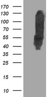 DLD / Diaphorase / E3 Antibody - HEK293T cells were transfected with the pCMV6-ENTRY control (Left lane) or pCMV6-ENTRY DLD (Right lane) cDNA for 48 hrs and lysed. Equivalent amounts of cell lysates (5 ug per lane) were separated by SDS-PAGE and immunoblotted with anti-DLD.