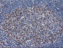 DLD / Diaphorase / E3 Antibody - IHC of paraffin-embedded Human lymph node tissue using anti-DLD mouse monoclonal antibody. (Heat-induced epitope retrieval by 10mM citric buffer, pH6.0, 100C for 10min).