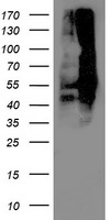 DLD / Diaphorase / E3 Antibody - HEK293T cells were transfected with the pCMV6-ENTRY control (Left lane) or pCMV6-ENTRY DLD (Right lane) cDNA for 48 hrs and lysed. Equivalent amounts of cell lysates (5 ug per lane) were separated by SDS-PAGE and immunoblotted with anti-DLD.
