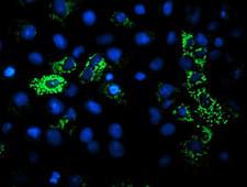 DLD / Diaphorase / E3 Antibody - Anti-DLD mouse monoclonal antibody immunofluorescent staining of COS7 cells transiently transfected by pCMV6-ENTRY DLD.