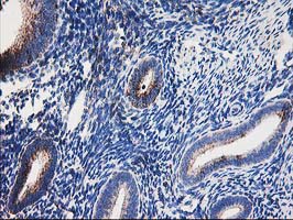 DLD / Diaphorase / E3 Antibody - IHC of paraffin-embedded Human endometrium tissue using anti-DLD mouse monoclonal antibody.
