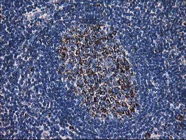 DLD / Diaphorase / E3 Antibody - IHC of paraffin-embedded Human lymph node tissue using anti-DLD mouse monoclonal antibody.