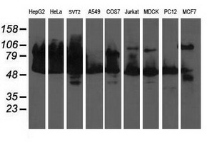 DLD / Diaphorase / E3 Antibody - Western blot of extracts (35 ug) from 9 different cell lines by using anti-DLD monoclonal antibody (HepG2: human; HeLa: human; SVT2: mouse; A549: human; COS7: monkey; Jurkat: human; MDCK: canine; PC12: rat; MCF7: human).