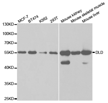 DLD / Diaphorase / E3 Antibody - Western blot analysis of extracts of various cell lines.