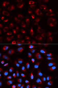 DLD / Diaphorase / E3 Antibody - Immunofluorescence analysis of U20S cells.