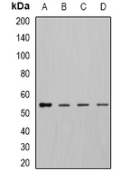 DLD / Diaphorase / E3 Antibody - Western blot analysis of DLD expression in MCF7 (A); K562 (B); mouse kidney (C); mouse liver (D) whole cell lysates.