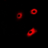 DLD / Diaphorase / E3 Antibody - Immunofluorescent analysis of DLD staining in U2OS cells. Formalin-fixed cells were permeabilized with 0.1% Triton X-100 in TBS for 5-10 minutes and blocked with 3% BSA-PBS for 30 minutes at room temperature. Cells were probed with the primary antibody in 3% BSA-PBS and incubated overnight at 4 deg C in a humidified chamber. Cells were washed with PBST and incubated with a DyLight 594-conjugated secondary antibody (red) in PBS at room temperature in the dark.