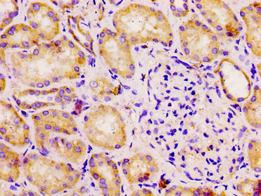 DLD / Diaphorase / E3 Antibody - Immunohistochemistry image at a dilution of 1:100 and staining in paraffin-embedded human kidney tissue performed on a Leica BondTM system. After dewaxing and hydration, antigen retrieval was mediated by high pressure in a citrate buffer (pH 6.0) . Section was blocked with 10% normal goat serum 30min at RT. Then primary antibody (1% BSA) was incubated at 4 °C overnight. The primary is detected by a biotinylated secondary antibody and visualized using an HRP conjugated SP system.