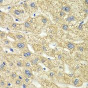 DLD / Diaphorase / E3 Antibody - Immunohistochemistry of paraffin-embedded human liver injury using DLD antibody at dilution of 1:100 (40x lens).