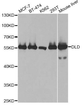 DLD / Diaphorase / E3 Antibody - Western blot analysis of extracts of various cell lines, using DLD antibody at 1:1000 dilution. The secondary antibody used was an HRP Goat Anti-Rabbit IgG (H+L) at 1:10000 dilution. Lysates were loaded 25ug per lane and 3% nonfat dry milk in TBST was used for blocking. An ECL Kit was used for detection and the exposure time was 5s.