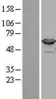 DLD / Diaphorase / E3 Protein - Western validation with an anti-DDK antibody * L: Control HEK293 lysate R: Over-expression lysate