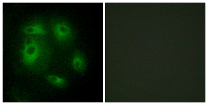 DLEC1 / DLC1 Antibody - Immunofluorescence analysis of HeLa cells, using DLEC1 Antibody. The picture on the right is blocked with the synthesized peptide.