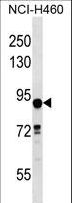 DLEC1 / DLC1 Antibody - DLEC1 Antibody western blot of NCI-H460 cell line lysates (35 ug/lane). The DLEC1 antibody detected the DLEC1 protein (arrow).