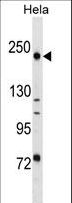 DLEC1 / DLC1 Antibody - DLEC1 Antibody western blot of HeLa cell line lysates (35 ug/lane). The DLEC1 antibody detected the DLEC1 protein (arrow).