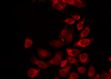 DLEC1 / DLC1 Antibody - Staining HepG2 cells by IF/ICC. The samples were fixed with PFA and permeabilized in 0.1% Triton X-100, then blocked in 10% serum for 45 min at 25°C. The primary antibody was diluted at 1:200 and incubated with the sample for 1 hour at 37°C. An Alexa Fluor 594 conjugated goat anti-rabbit IgG (H+L) Ab, diluted at 1/600, was used as the secondary antibody.