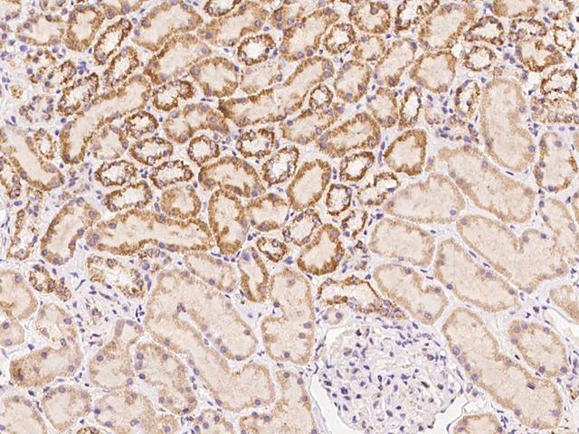 DLEC1 / DLC1 Antibody - Immunochemical staining of human DLEC1 in human kidney with rabbit polyclonal antibody at 1:100 dilution, formalin-fixed paraffin embedded sections.