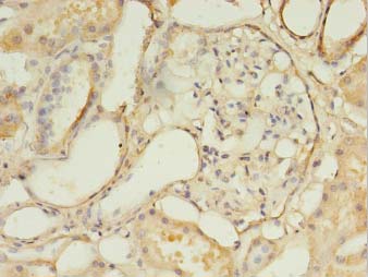 DLEU1 Antibody - Immunohistochemistry of paraffin-embedded human kidney tissue using antibody at 1:100 dilution.