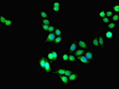 DLEU1 Antibody - Immunofluorescent analysis of PC-3 cells using DLEU1 Antibody at dilution of 1:100 and Alexa Fluor 488-congugated AffiniPure Goat Anti-Rabbit IgG(H+L)