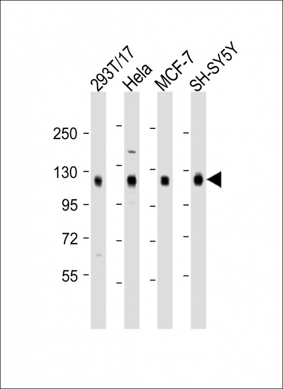 DLG1 / SAP97 Antibody - All lanes: Anti-DLG1 Antibody (Center) at 1:2000 dilution. Lane 1: 293T/17 whole cell lysate. Lane 2: HeLa whole cell lysate. Lane 3: MCF-7 whole cell lysate. Lane 4: SH-SY5Y whole cell lysate Lysates/proteins at 20 ug per lane. Secondary Goat Anti-Rabbit IgG, (H+L), Peroxidase conjugated at 1:10000 dilution. Predicted band size: 100 kDa. Blocking/Dilution buffer: 5% NFDM/TBST.